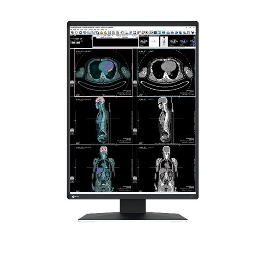 EIZO EIZO MONITOR MEDICALE 21,3 LED IPS 1536 X 2048 3:4 25 ms 1100 CDM, DP/DVI, PIVOT, RADIFORCE RX2370 - MONITOR LED | TecnoCARE.net Sabaudia, Latina, Terracina, San Felice Circeo e Pontinia